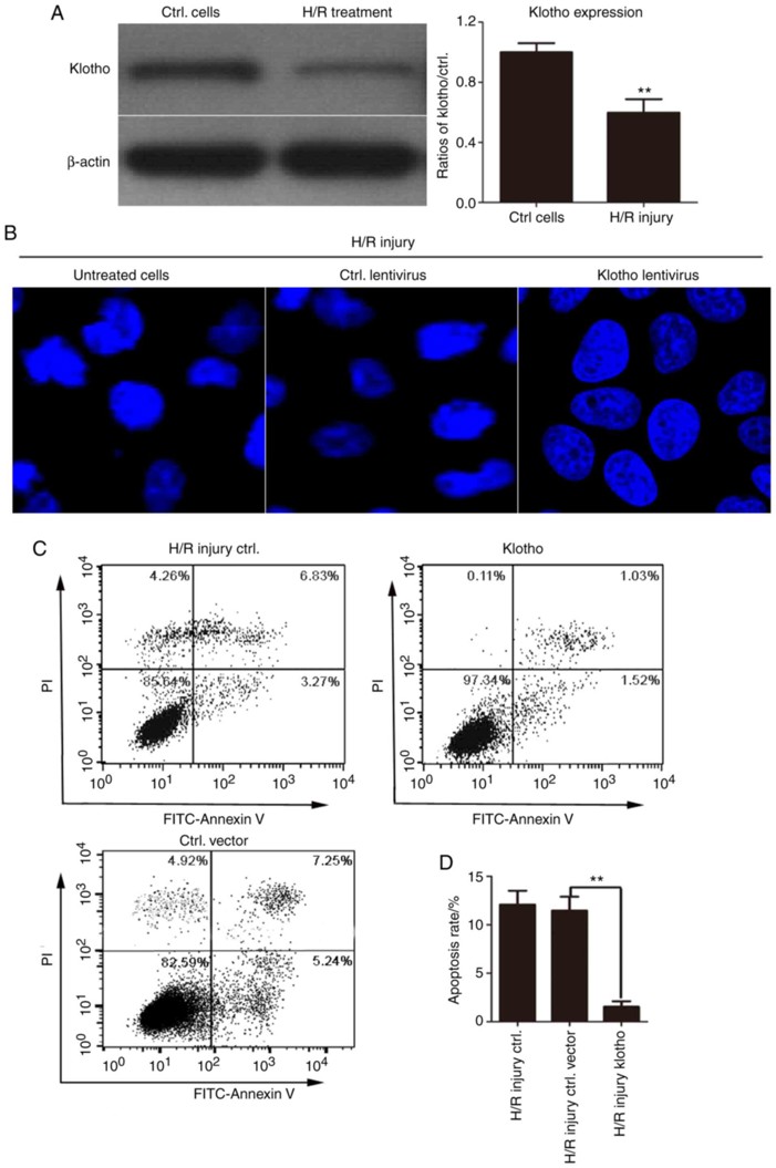 Klotho overexpression markedly inhibits H/R-induced apoptosis in H9c2(2-1) cells.