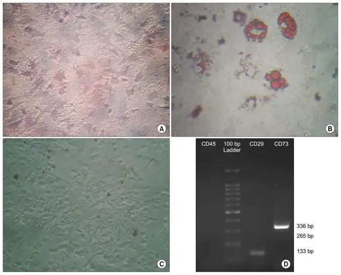 Bone marrow-derived mesenchymal stem cells of hamster cultivated in (A) osteogenic medium and stained with Alizarin Red (×100), (B) in adipogenic medium and were stained with Oil Red O at day 21 after induction (×200), and (C) in culture media without differentiation medium as control (×100). (D) Activation of specific mesenchymal marker (CD29 and CD73) compared with deactivation of specific hematopoietic marker (CD45) of hamster bone marrow-derived stem cells.