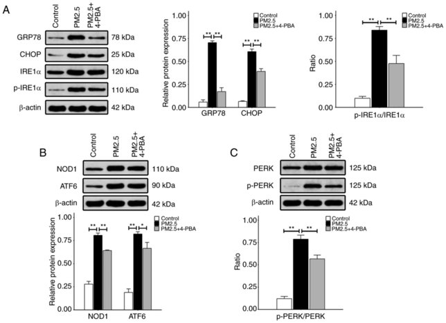 Expression of endoplasmic reticulum stress-related proteins in HBE135-E6E7 cells.