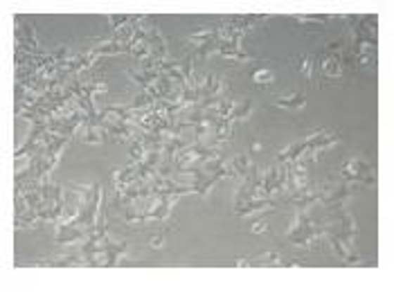 Represents normal HCT-15 cell line.