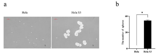 Tumorospheres formation assay of Hela and Hela S3 cells.