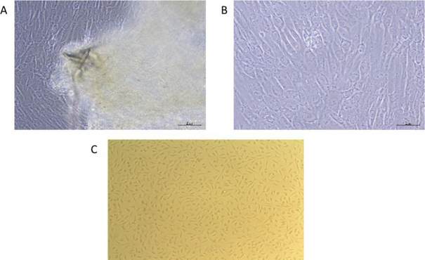 Morphological characteristics of Fibroblast-like hUC-MSCs.