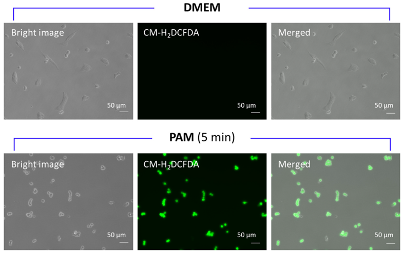 Representative fluorescence microscopic images of cells treated with PAM (5 min) or DMEM after CM-H2DCFDA pretreatment for observing intracellular ROS accumulation induced by PAM.