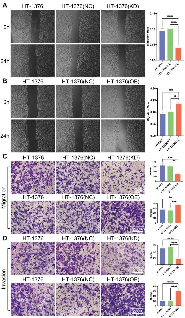 Effect of S100A8 on migration and invasion in HT-1376 cells.