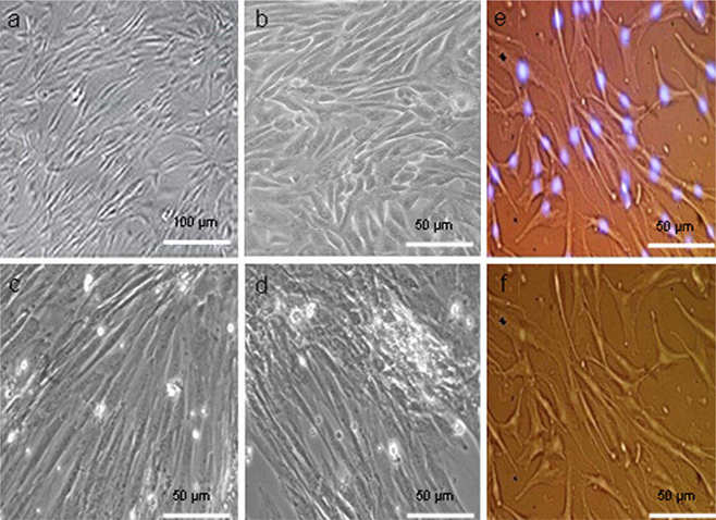 Fig. 1. Morphological features of human adipose-tissue-derived stem cells.