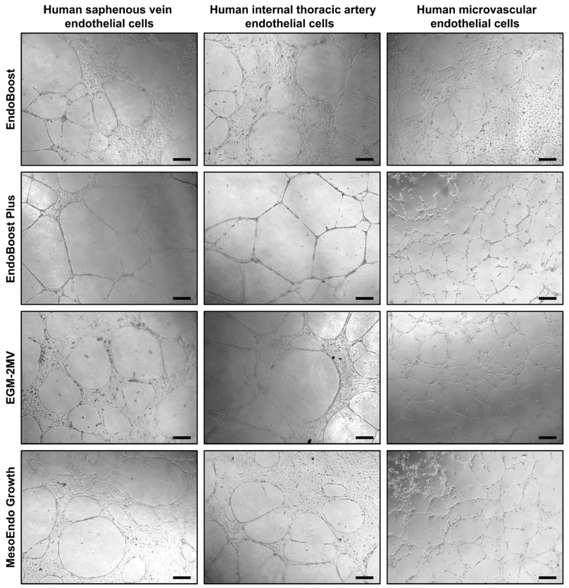 Formation of capillary-like tubes by primary human saphenous vein endothelial cells (HSaVEC), human internal thoracic artery endothelial cells (HITAEC), and human adipose tissue-derived microvascular endothelial cells (HMVEC) after 24 h of culture in various endothelial cell media and in a three-dimensional gel matrix recapitulating the composition of the endothelial basement membrane.