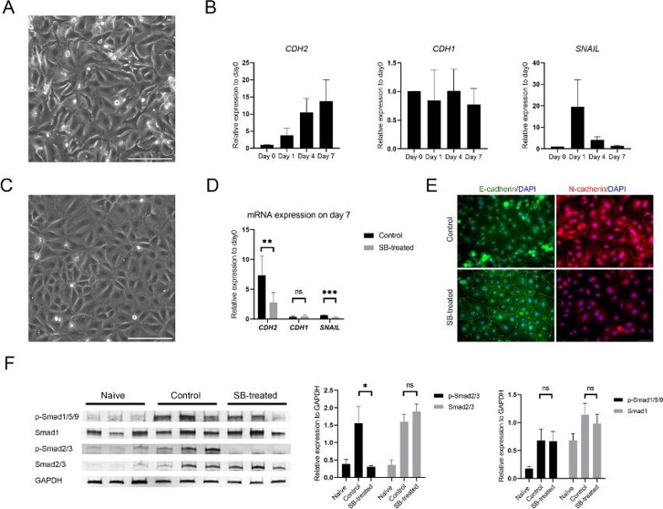 TGF-β-dependent EMT in hAECs and the effect of SB-431542 supplementation.
