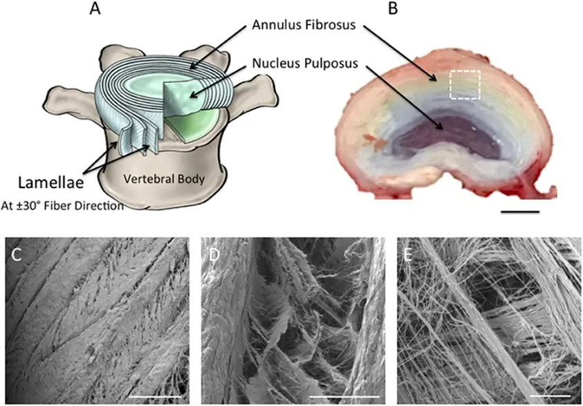(A) Schematic diagram representing intervertebral disc in (B).
