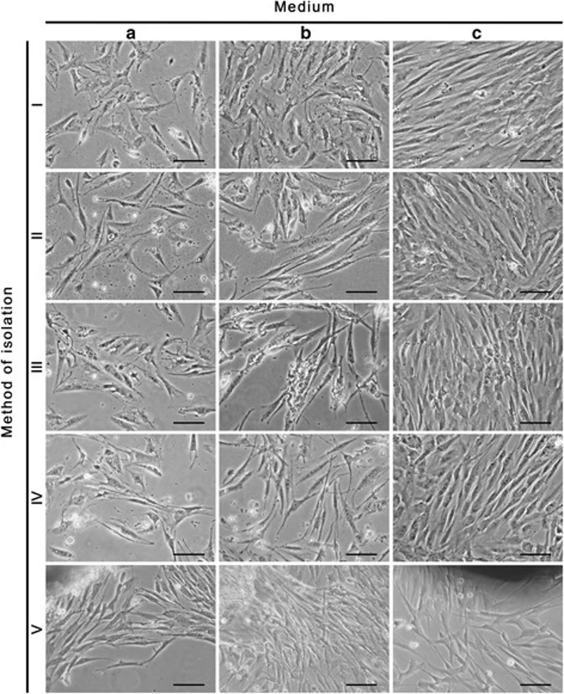 Bladder smooth muscle cells in the fifth day of culture. Cells isolated by methods I-V and cultured in three different media: DMEM HG with FBS Pan-Biotech (a), DMEM HG with FBS Sigma (b) and SmGM-2 (c).
