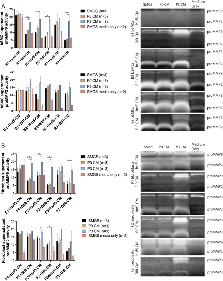 pro-MMP2 and pro-MMP9 activity of pSMC-CM-treated bSMCs (a) and vaginal fibroblasts (b).