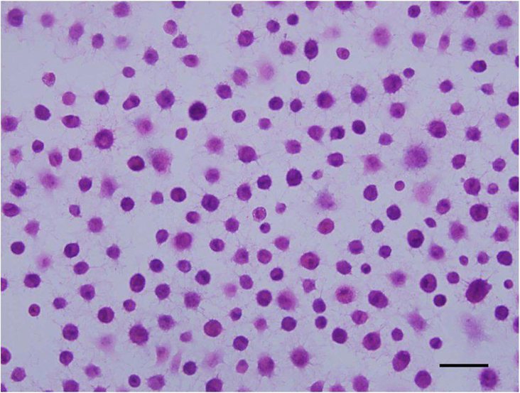 Mononuclear cells in bone marrow after extraction.