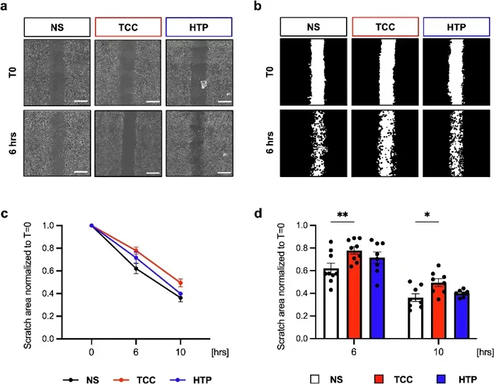 CSC migration capacity in response to serum lots of smokers.