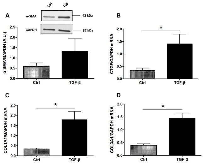 Expression of ECM-associated proteins in TGF-β-stimulated colonic fibroblasts CCD-18Co.