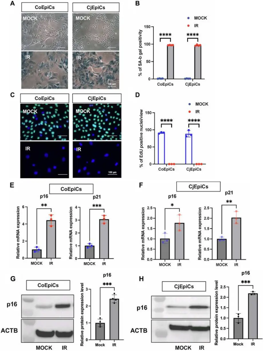 Characteristic of X-irradiated human corneal epithelial cells (CoEpiCs) and conjunctival epithelial cells (CjEpiCs) (Kitazawa, Koji, et al., 2023).