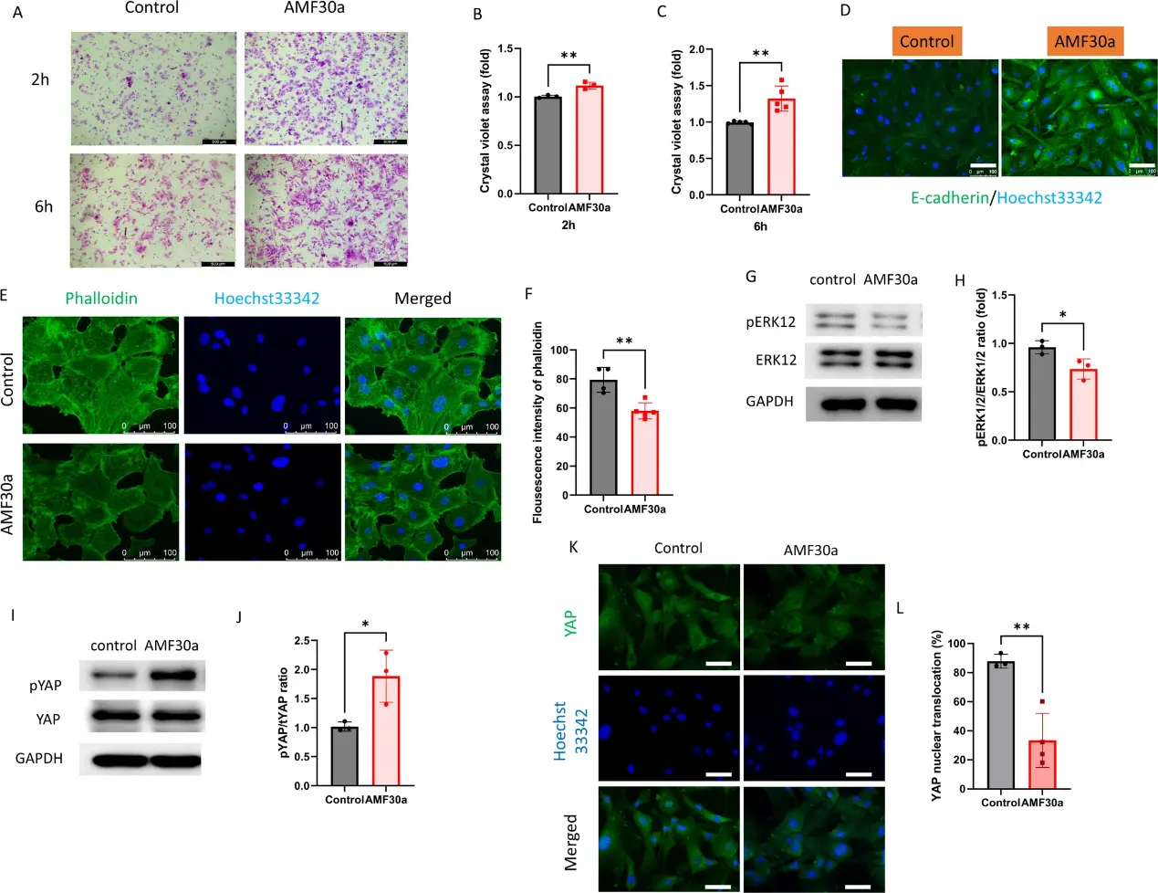 AMF30a promotes the adhesion of human corneal endothelial cells through HIPPO signaling pathway.