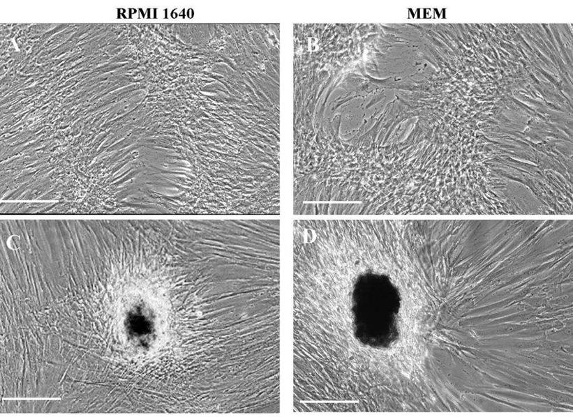  Morphology of human dental pulp cells maintained in RPMI 1640 (A, C) or MEM (B, D) for 20 days (A, B) and 30 days (C, D) as described in Materials and Methods.