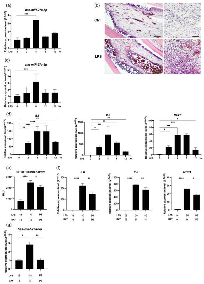 NF-κB signaling induces synthesis of miR-27a-5p and proinflammatory cytokines in LPS-stimulated hDPCs.
