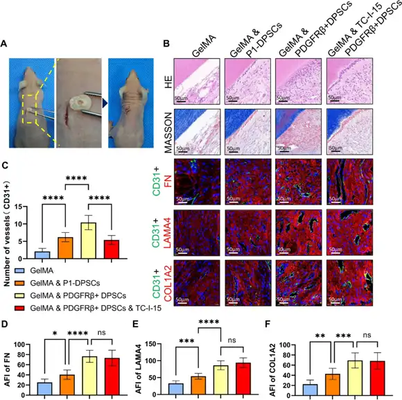 In vivo evaluation of PDGFRβ+ DPSC-loaded GelMA for dental pulp-dentin complex regeneration