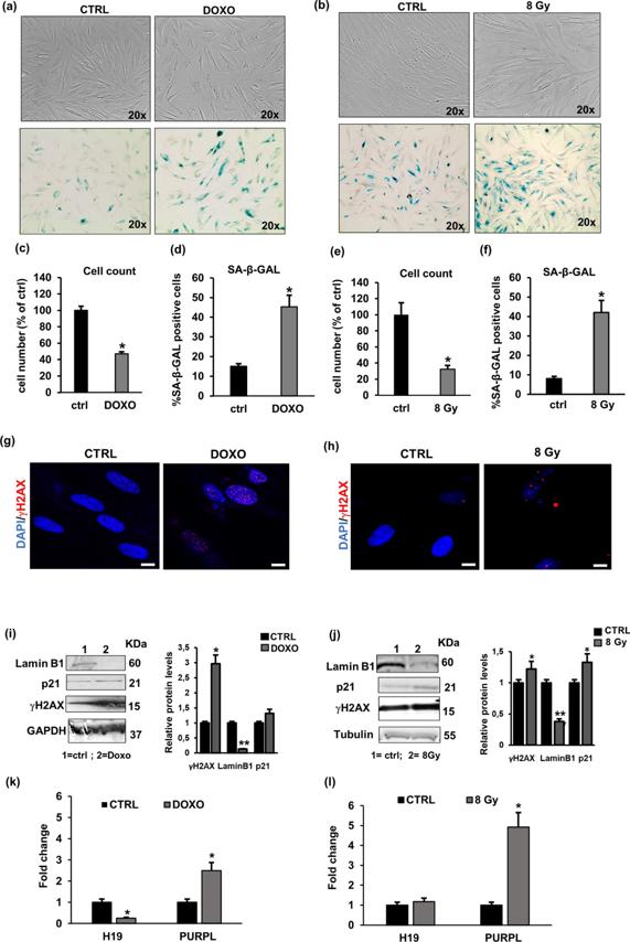 Pre-senescent NHDFs were subjected to chronic treatment with resveratrol 5  M for 5 weeks (senR5), young NHDFs and sen NHDFs were used as controls.