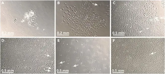 Images of P0-P1 primary human dermal microvascular endothelial cells (HDMECs) in culture. (A-D) Image of HDMEC P0 culture on day 1, 4, 6 and 8. (E-F) Image of HDMEC P1 culture on day 1 and 5.