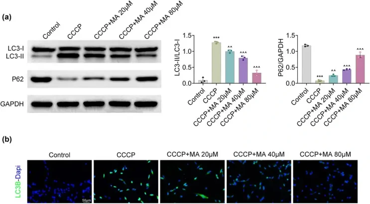 MA restrained autophagy in HGSMCs.