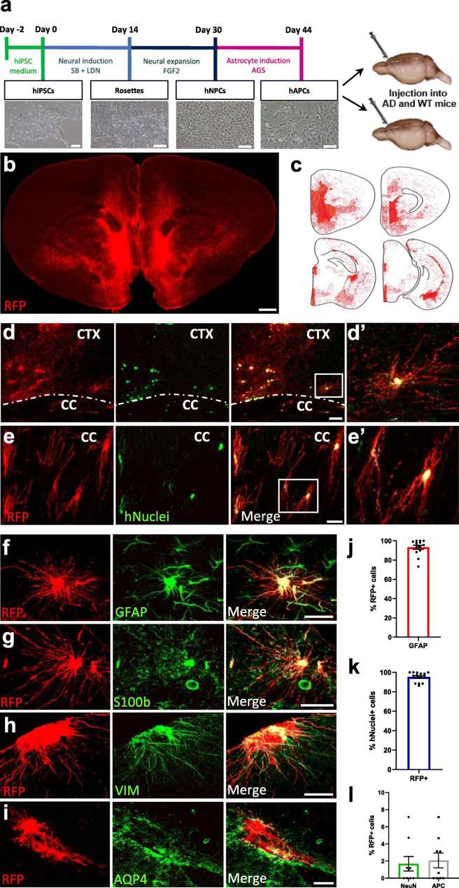 hiPSC-astrocyte progenitors engraft the mouse brain and differentiate into astrocytes within chimeric AD and WT mice.