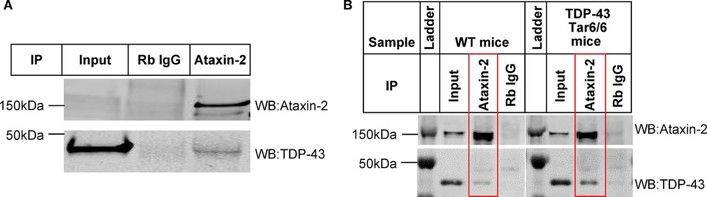 Ataxin-2 co-immunoprecipitated with TDP-43 in iPSC-derived neurons and mouse brain tissue.