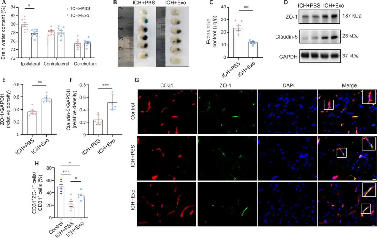 hiPSC–NSC–Exos improve BBB integrity on day 3 post-ICH.