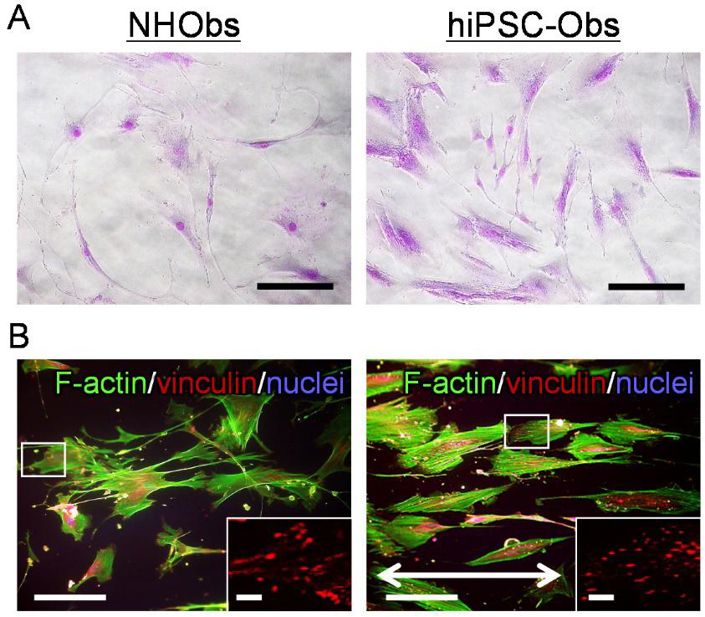 Observation of the cell behavior of human-induced pluripotent stem cell-derived osteoblasts (hiPSC-Obs) on a bone-mimetic collagen scaffold.