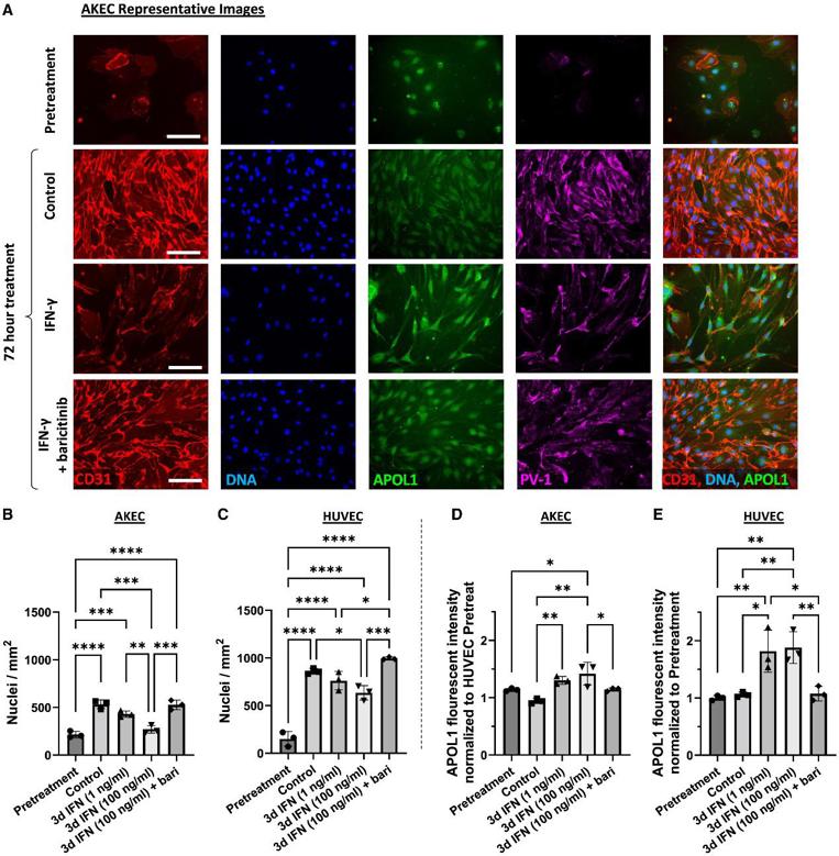Human adult kidney endothelial cells are particularly sensitive to IFN-γ treatment.