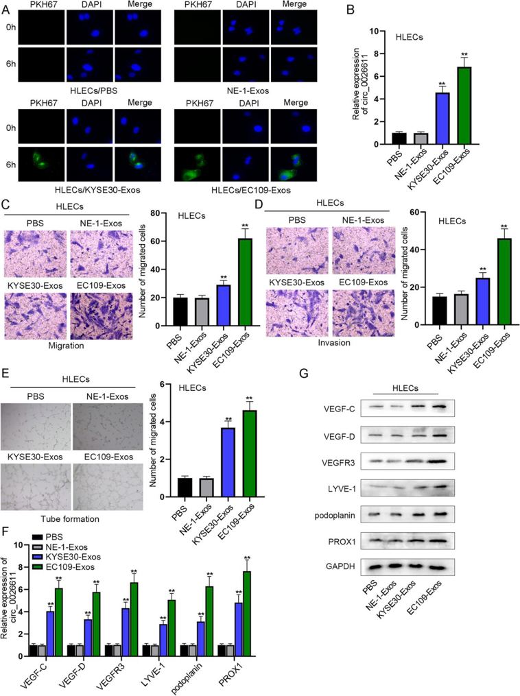 ESCC cell-derived exosomes promoted the migration, invasion, and lymphangiogenesis of HLECs.