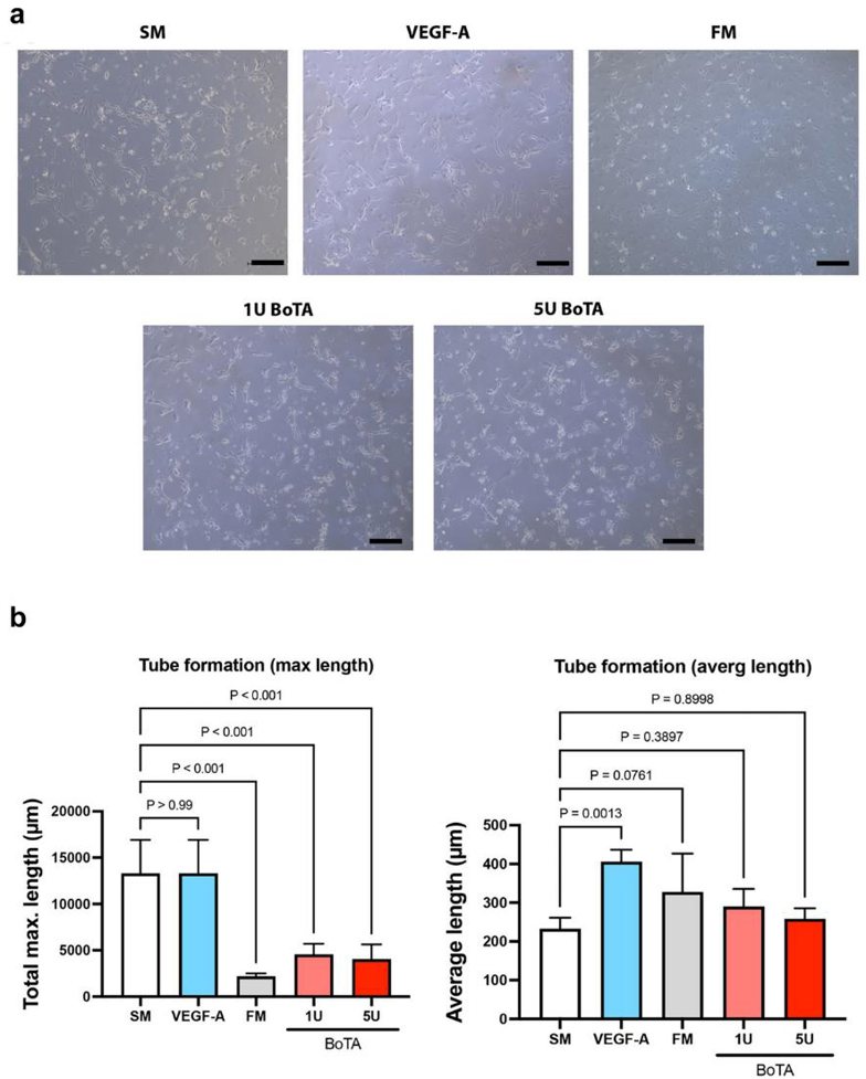 BoTA reduced the maximum length of LEC cord formation, while average length remained unaffected.