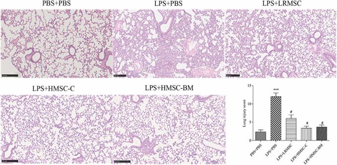 Histological evaluation of lung injury. Lung sections were stained with hematoxylin and eosin.