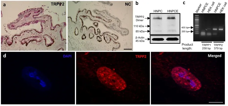 The expression of TRPP2 in human ciliary body and HNPCE cells.