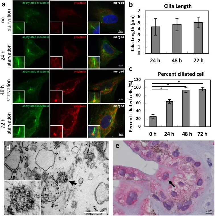 Formation of primary cilia in HNPCE cell culture and human ciliary body epithelium