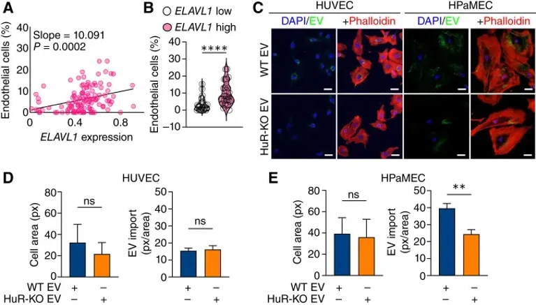 Endothelial cell abundance correlates with ELAVL1 expression, and endothelial cells import PDAC EVs