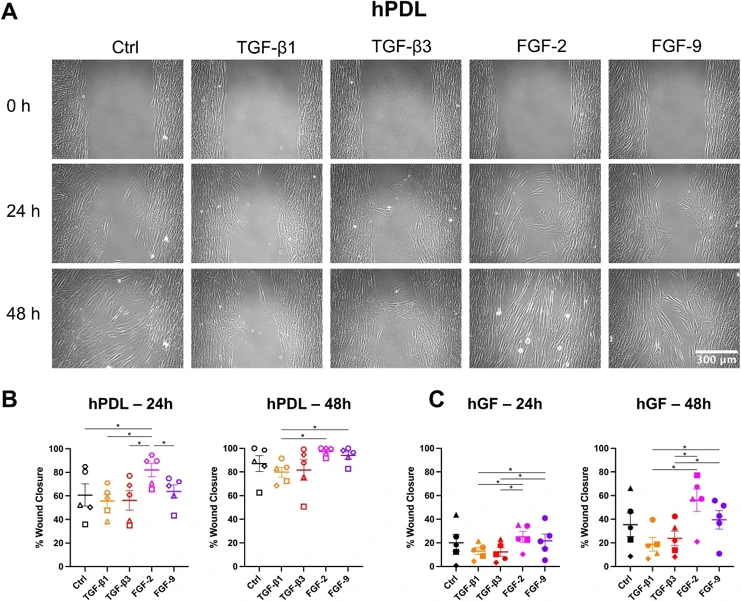 FGF-2 enhanced migration.