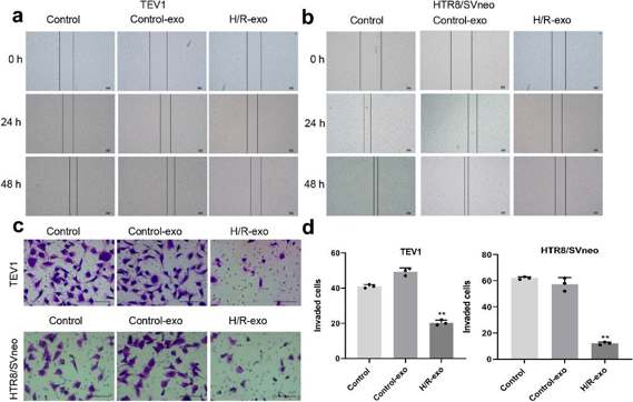 Exosomes derived from HPVECs deliver miR-486-5p to inhibit the migration and invasion of trophoblast cells via targeting IGF1.