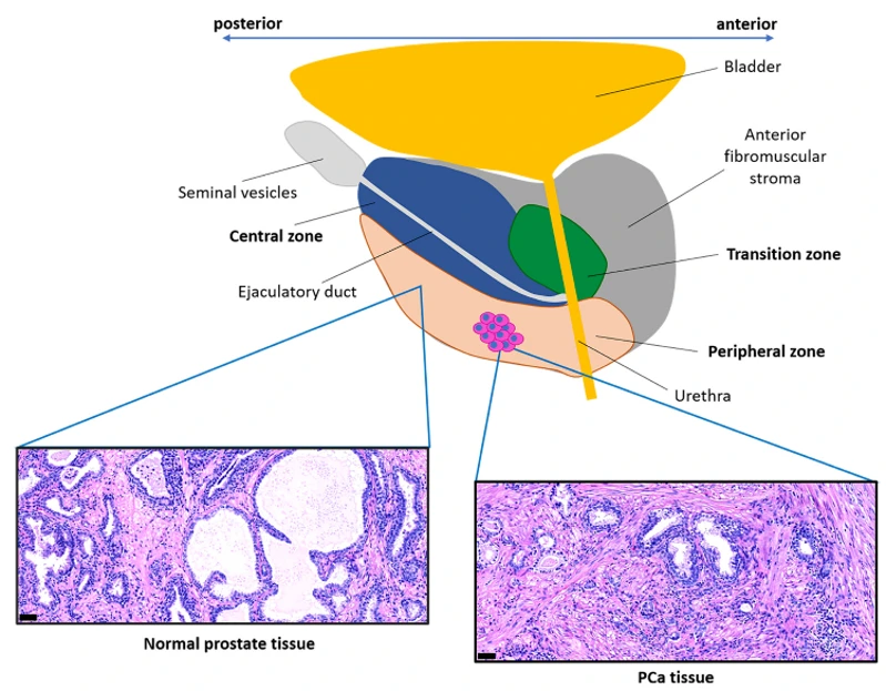 Prostate anatomy. Representation of the prostate anatomy oriented in the anterior-posterior body axis, with the prostatic zones highlighted in different colors.