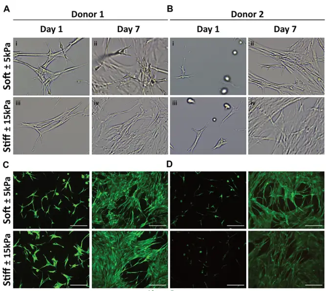 Primary human lung fibroblast morphology, live/dead staining and proliferation on soft (3.94 ± 0.87 kPa) and stiff (11.34 ± 3.82 kPa) GelMA hydrogels.