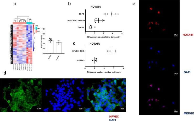 Expression of HOTAIR is specifically up-regulated in COPD patient lungs and CSE-induced HPVEC.