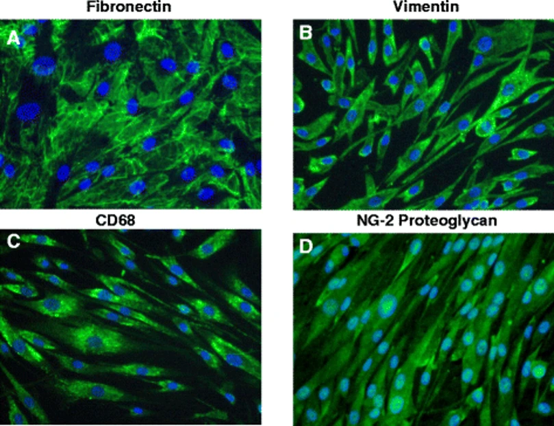 Human cytomegalovirus (HCMV) infectivity of primary human retinal pericytes.