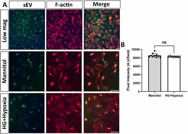 Uptake of HRP sEV by HREC (Human Retinal Endothelial Cells).