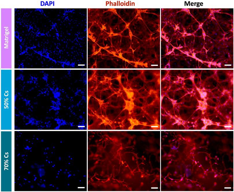 DAPI-Phalloidin staining at day 4. Nuclei in blue, actin filaments in red in non-RA hFLS. 