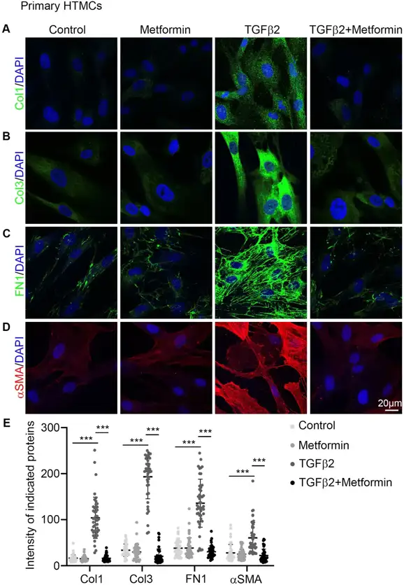 Metformin rescues fibrosis induced by TGFβ2 in primary human trabecular meshwork cells (HTMCs).
