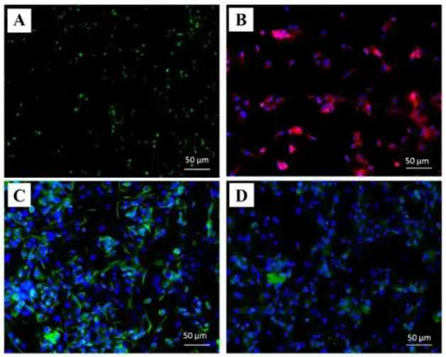 Chondrocyte characterization by ICC, (A) Sox9 (green; nuclear marker), (B) Aggrecan (red), (C) type II collagen (green), (D) type X collagen (green).