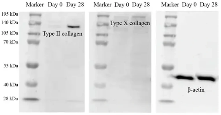 Type X collagen protein expression analysis of chondrocyte differentiated cells at day 28 by immunoblot, and β-actin protein was used as an internal control. Western blotting was carried out in duplicate.