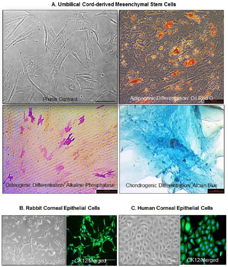 Umbilical cord-derived mesenchymal stem cells (UC-MSCs) were cultured in Cytomix medium (Miltenyi Biotec GmbH, Bergisch Gladbach, Germany) and their adipogenic, osteogenic, and chondrogenic differentiation was studied using Oil Red O, Alkaline Phosphatase, and Alcian Blue, respectively.