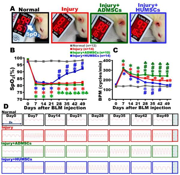 Transplantation of HUMSCs, but not ADMSCs, improved pulmonary function in rats with PF.