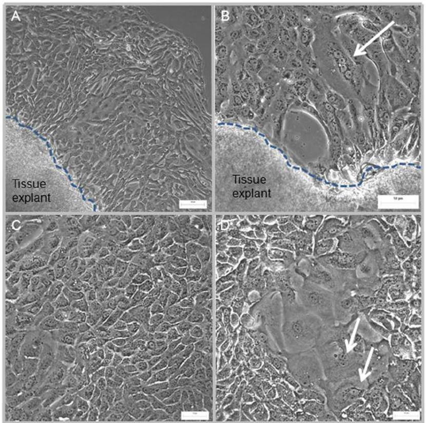 Cellular morphology of human urothelial cells (HUCs) generated from bladder tissue explant.